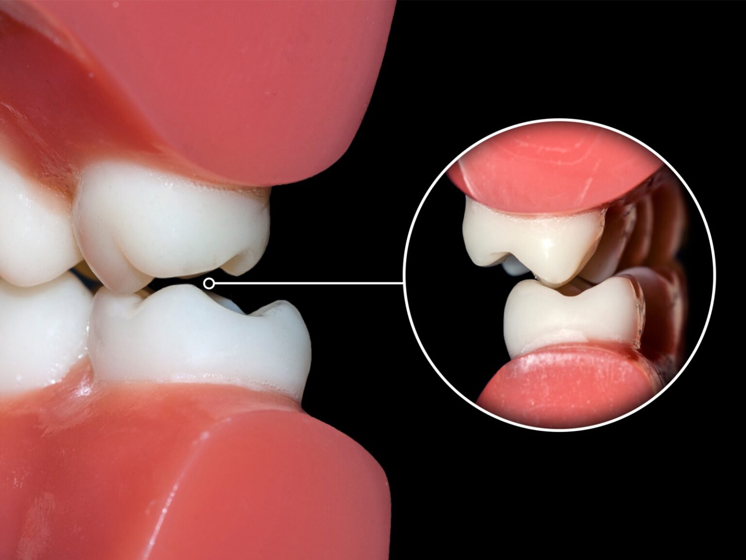 Occlusal Cyclic Loading at Kathryn Holley blog