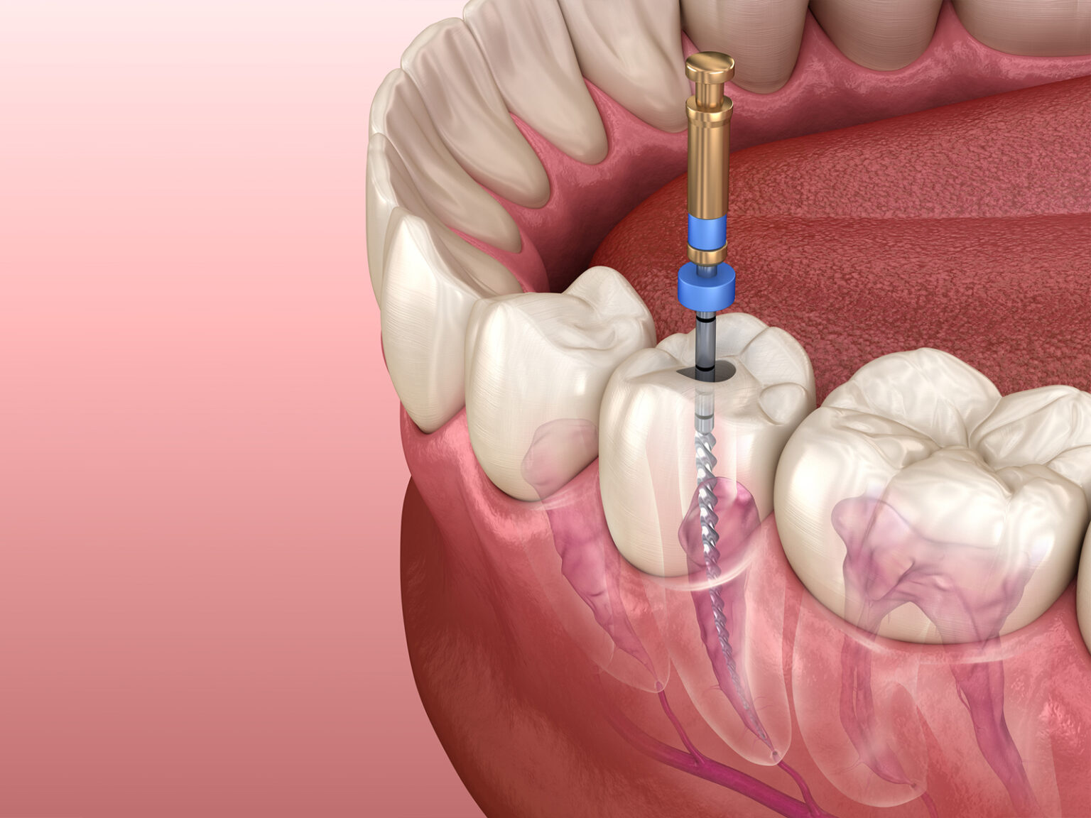 what-are-the-symptoms-of-a-tooth-infection-spreading