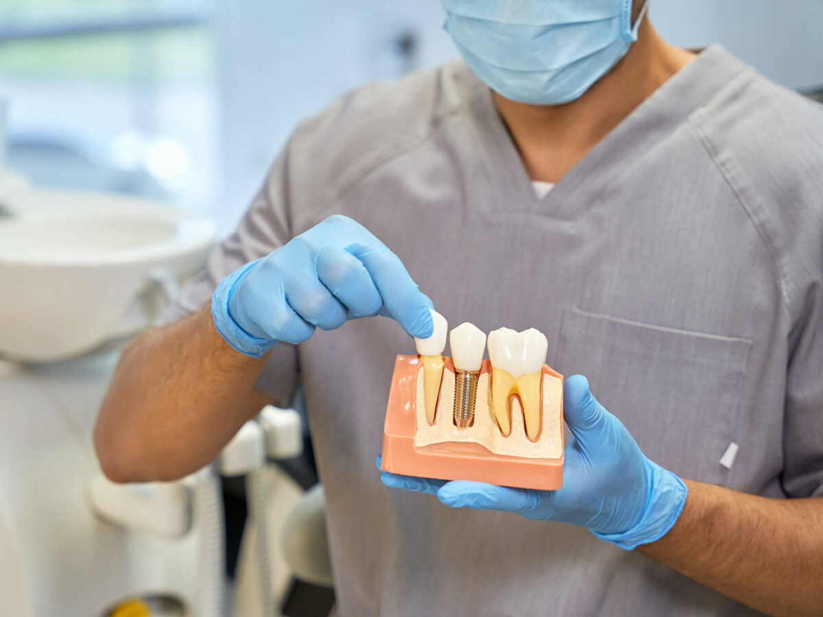 What Are The 3 Stages of Dental Implants?