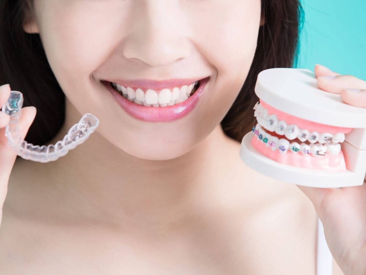 Are You A Good Invisalign Candidate?