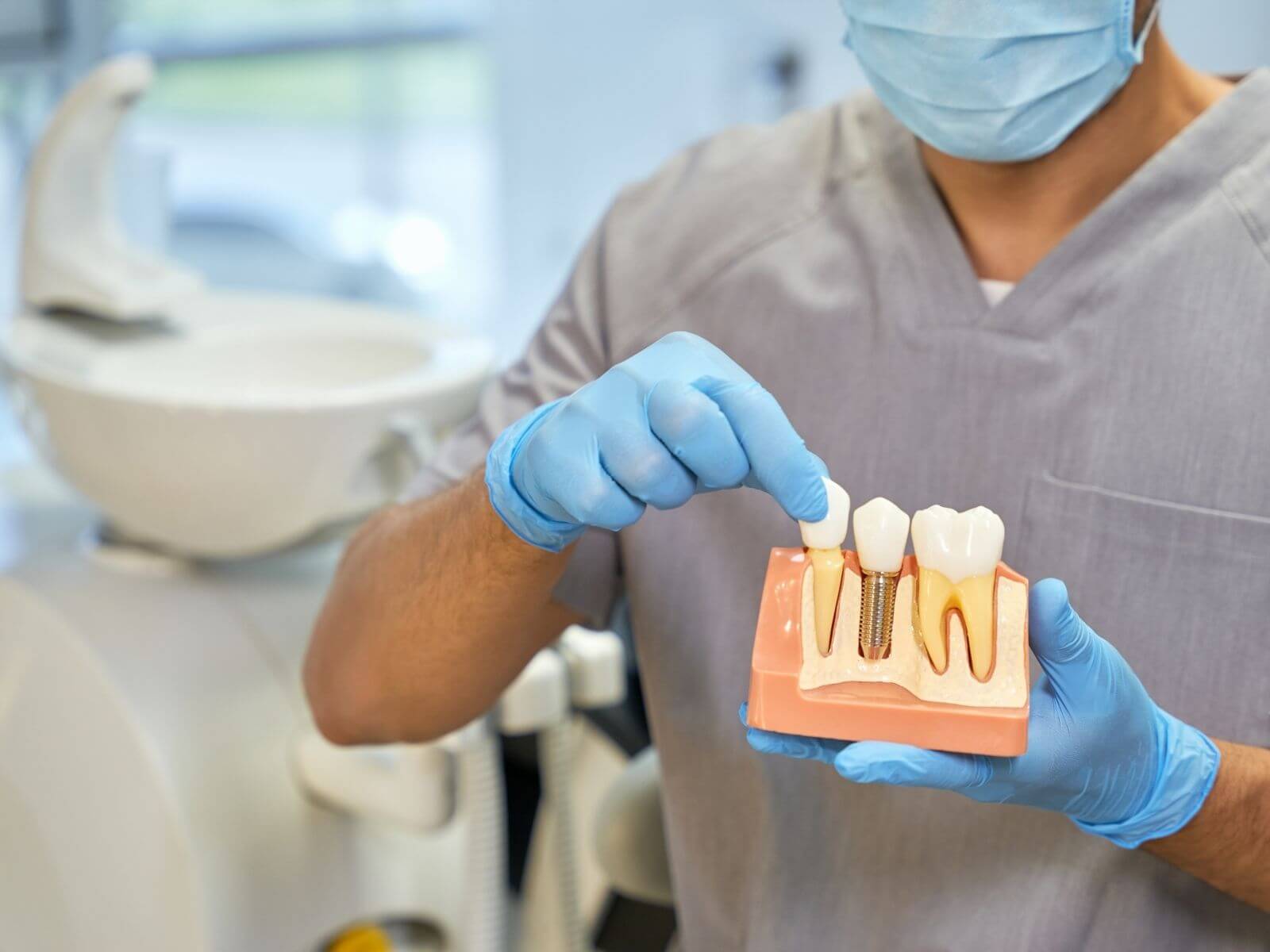 Understanding the Lifespan of Dental Implants